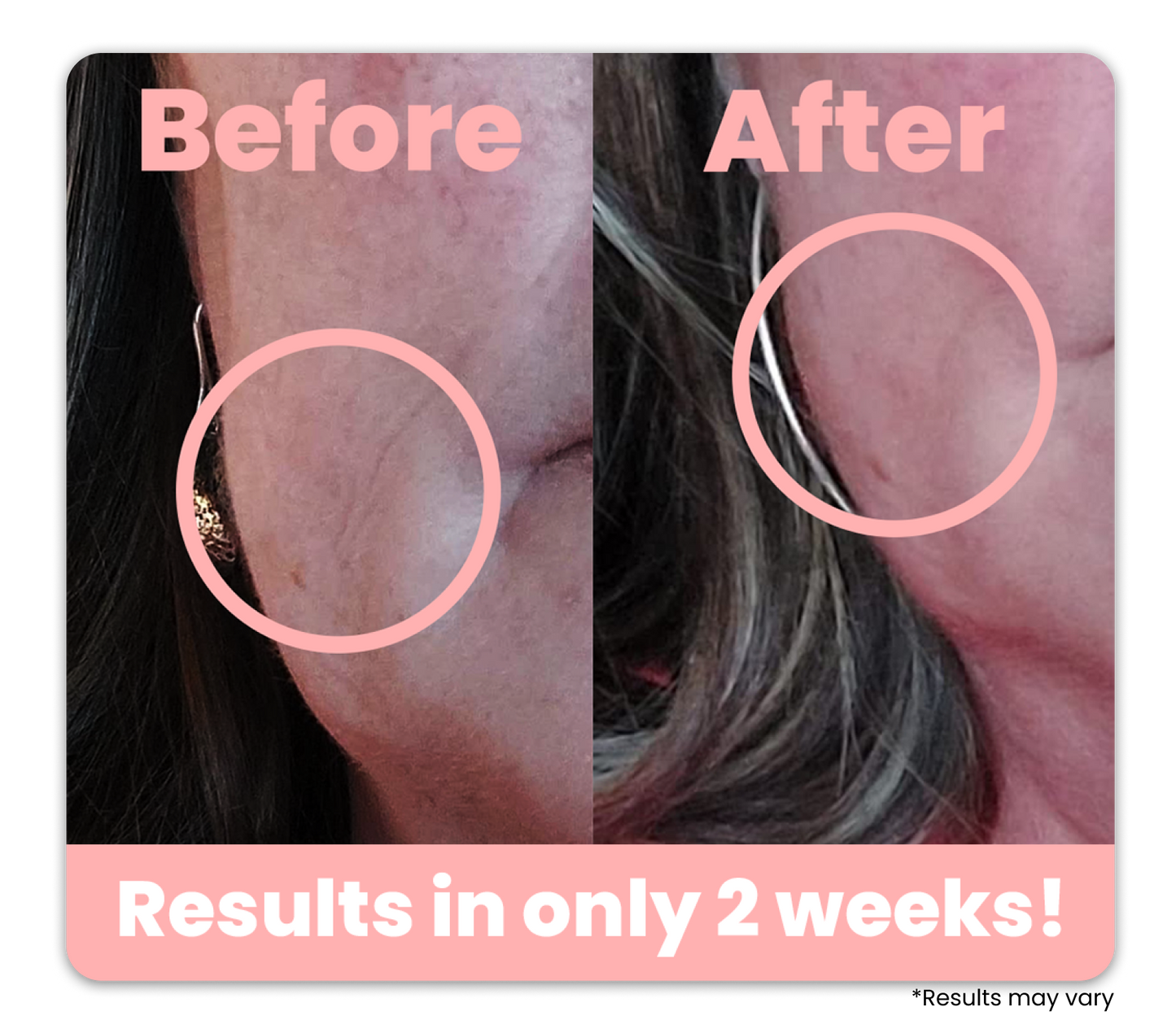 Light Therapy Beauty Device